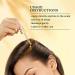 Indu..lekha Sve..tak..utaja Scalp Serum Dandruff Treatment Silicone & Paraben Free Ayurvedic Formula - Buy Online on GoSupps.com