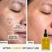 Karmic Skin Brightening Vitamin C Face Serum: With Saffron & Vit. E | Hydrate & Reveal Bright Glowing Skin | Correct Dark Spots | Treat Hyperpigmentation | Organic Facial Oil Skin Care | Women & Men - Buy Online on GoSupps.com