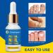 Fungal Nail Treatment - Natural Antifungal Solution for Toe Fungus - 1oz/30ml - Buy Online on GoSupps.com