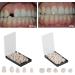 Tooloflife Temporary Tooth Crown - 70 Parts Box Realistic Provisional Dental Care for Front & Back Teeth (140 Pieces) | International Shipping Available - Buy Online on GoSupps.com