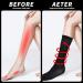 Surgical Compression Socks for Women & Men - 2 Pairs | 20-25mmHg Knee-High Varicose Veins Stockings for Running, Travel, Nursing, Pregnancy - S-M to XXL Sizes - Buy Online on GoSupps.com