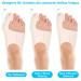 Soarfly Hallux Valgus Correction | Adjustable Bandage & Non-Slip Heel Strap for Pain Relief Day & Night Support for Foot Problems - Buy Online on GoSupps.com