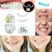 Buy Flipped Warm Cosmetic Veneers - Provisional False Teeth & Braces Smile Prosthetics for a Perfect Smile Worldwide - Buy Online on GoSupps.com