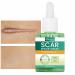 Imtrub Scar Guards Moisturizing Scar Repair Oil for Skin Repair 30 ml Scar Repair Smoothing to Reduce Scar Scars Pregnancy