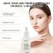 S rum la niacinamide - Essence hydratante pour le visage - 10 % niacinamide + 1 % de zinc - Convient pour tous les types de peau - 30 ml - Buy Online on GoSupps.com