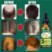 dijiusidy Ginger Hair Growth Oil Prevent Baldness Good-absorption Fast Growing 30MLSerum Nourish Tools Female - Buy Online on GoSupps.com