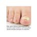 Cabs Nail Care and Foot Cream - Nail Fungus Prevention Lotion Drops - Buy Online on GoSupps.com
