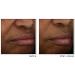 RoC Multi Correxion Revive + Glow 10% Vitamin C Blend Face Moisturizer Anti-Aging Gel Cream for Instant Glow Hypo-Allegenic & Oil-Free Skin Care 50ML - Buy Online on GoSupps.com