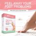 Soft Touch Foot Peel Mask - Pack of 2 for Dry Cracked Heels & Calluses | Exfoliating Foot Mask with Aloe Vera for Baby Soft Skin - Buy Online on GoSupps.com