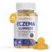 Sugar-Free Eczema Treatment Gummies — USA-Made 10x Effective 20+ Vitamins Support Eczema Treat Psoriasis Rosacea & Dermatitis — Healthy Skin Soothes Itching & Redness (60 Gummies)