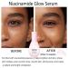 Watermelon Niacinamide Moisturizer - Hydrating Facial Serum with Hyaluronic Acid & Vitamin E | Brightening Glow Dew Drops (60ml) - Buy Online on GoSupps.com