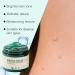  yxcully DermaEase Natureerase Gel for Instantly Removing Moles and Spots Removes Dark Spots for Face and Body Professional Skin Repair Cream Reduced - Buy Online on GoSupps.com