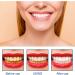 7 Days Tooth Elevator Powder | Organic Tooth Whitening & Stain Removal | Refreshing Mint Flavor - 1PC - Buy Online on GoSupps.com