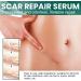 PARWENE ScarRevita Advanced Repair Serum - Effective Scar Removal Spray for All Skin Types (3pcs) - Buy Online on GoSupps.com