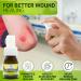 B Alive Pro Antimicrobial Skin Repair Spray - Natural Non-Toxic First Aid for Cuts, Scrapes, Rashes, Sunburns - No Sting Formula - Buy Online on GoSupps.com