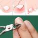 Nail Clippers Pedicure Kit Manicure Set Dead Skin Tools with Storage Bag - Buy Online on GoSupps.com