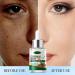 Licorice Root Extract for Skin - Licorice Root Serum Licorice Root Oil Drops Moisturizing Face Oil Licorice Root Extract Anti-Shrinking Pores Face Oil (2Bottle) - Buy Online on GoSupps.com