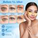 Under Eye Gel Patches Eye Pads Eye Mask Against Dark Circles Eye Bags Wrinkles Dark Circles & Puffiness Gold Eye Pads with Hyaluronic & Collagen for Anti-Ageing (1 Pair) - Buy Online on GoSupps.com