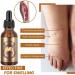 Premium Lymph Cleanse Herbal Detox Oil - Apolloostory Ginger Massage Oil for Relaxation & Stress Relief (1 Pc) | International Shipping Available - Buy Online on GoSupps.com