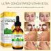 Vitamin E oil 60 ml pure and organic vitamin E oil for skin face hair nails and scars intensive care for dry skin antiaging moisture and regeneration 75000 IU 1 - Buy Online on GoSupps.com