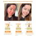 LOVILDS Bee Venom All-in-One Cream 2025 New Professional Bee Venom Skin Treatment Cream Moisturizing & Repair Reduces Blemishes Natural Serum Suitable for All Skin Types (2PCS) 2PCS 1 Fl Oz (Pack of 1) - Buy Online on GoSupps.com