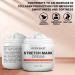 Mystre Beaut Stretch Mark Cream - Reduces Stretch Marks, Moisturizes Skin with Cocoa Butter & Shea Butter - Vitamins A & E Skincare for Mamas - All Skin Types - 4 oz - Buy Online on GoSupps.com