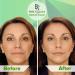 Retinol Moisturizer with Hyaluronic Acid for Face & Eye - 2.5% Active Retinol, Vitamin E - Reduce Wrinkles & Fine Lines - Day & Night Cream - Buy Online on GoSupps.com