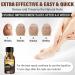 Extra Strength Toenail Treatment - Nail Treatment for Fungus & Discoloration (1 fl oz/30 ml) | Effective Toe Nail Solutions - Buy Online on GoSupps.com