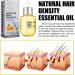 Huile paississante Naturelle pour Cheveux - 30 ml. Une formule douce adapt e la chute de cheveux post-partum/h r ditaire paissit les cheveux en 8 semaines. 1 - Buy Online on GoSupps.com