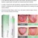 3 PCS Canada Polumna Fissured Tongue Relief Spray | Best 2023 Treatment for Oral Health - Buy Online on GoSupps.com