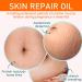 Huile de Soin Pour la Peau Huile De Vergeture Pendant la grossesse huile corps pour R duit Les Postnatal Vergetures cicatrices peau s che et teint irr gulier 125ML - Buy Online on GoSupps.com