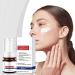 Whitening & Freckle Removing Essence - 30ml Vitamin C Spot Cream for Melasma Melanosis Acne Scars - Best Skin Brightening Serum - Buy Online on GoSupps.com
