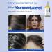 Hair Growth for Women 30ml Hair Oil Roll-On - Natural Hair Thickening and Growth | For Frizz Follicle Slimming Men's Health Seniors Home Travel - Buy Online on GoSupps.com