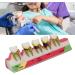 Realistic Dental Periodontitis Model - Study Dental Teeth in Various Stages | Synthetic Resin Educational Tool - Buy Online on GoSupps.com