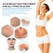 Silicone Scar Gel - Physician Formulated Treatment Cream for Keloids, C-Section, Burn, Surgery & Acne - Effective on Old & New Scars - Buy Online on GoSupps.com