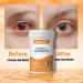 Natener 14 in 1 Eye Vitamins 25mg Lutein 5mg Zeaxanthin 24mg Astaxanthin 800mg Omega-3 & 100mg L-Theanine Supports Eye Health Moisture and Comfort* - Buy Online on GoSupps.com