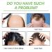 Essential Oil for Hair Density & Growth - 30ml Aibyks Natural Wild Hair Growth Oil - Buy Online on GoSupps.com