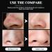 40 Blackhead Strips - Intensive Pore Cleaning for Clear Radiant Skin | Remove Blackheads with Effective Nasal Pore Strips - Buy Online on GoSupps.com