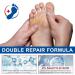  G n rique Urea Cream 60% Moisturizing Repair Foot Cream Deeply Hydrates and Softens Cracked Heels Cream for Very Dry and Damaged Feet 40g (3) - Buy Online on GoSupps.com