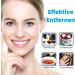 Whitening Strips - Natural Teeth Whitening Strips for Quick Effective Bleaching & Stain Removal - Buy Online on GoSupps.com