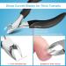 Toenail Clippers for Seniors Thick Toenails Toe Nail Clippers Set for Ingrown Toenail Men and Adults Professional Super Sharp Curved Blade Grooming Tool Predicure - Buy Online on GoSupps.com