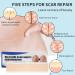 Silicone Scar Sheets for Treatment & Removal - Reusable, Professional Grade - C-Section, Surgery, Acne, Keloid - 1.6x6 (4 Pack) - Buy Online on GoSupps.com