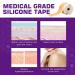 Silicone Scar Sheets (1.6 x 120 Roll) - 3M Scar Removal Tape for Softening Acne, C-Section, Keloid Scars - Painless & Reusable - 10-12 Month Supply - Buy Online on GoSupps.com