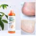 Foot Peeling Spray with Orange Oil Exfoliate Dead Skin & Calluses Fast | Hydrating & Nourishing Formula - Buy Online on GoSupps.com