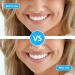 100 Interdental Brushes for Superior Oral Hygiene | Intermediate Brushing Tool with Lid - Perfect for Home Use - Buy Online on GoSupps.com