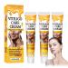 Crsetmyth Vitiligo Care Cream Skin Lightening and Repair Treatment 50ml