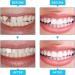 70PCS Temporary Tooth Crown Repair Kit - Dental Replacement Caps for Front Teeth - Oral Care Resin Crowns for False Tooth - Dental Repair Kit Included - Buy Online on GoSupps.com