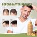 Hair Growth Serum with Radix Polygonum Multiflorum - Fight Hair Thinning & Fall | 50ml | Strengthen & Thicken Hair for Men & Women - Buy Online on GoSupps.com