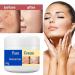 Melasma Treatment for Face Removes Facial Melasma Dark Spots Spot Cream Hyperpigmentation Treatment Sun Spots and Melasma Freckle Remover Remove Dark Spots Pigmentation Removal Cream for Face - Buy Online on GoSupps.com