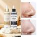 KYDA Peel Shot Glow Rice Ampoule Duo Black and White Rice Peeling Ampoule Soft Rice Exfoliating Face and Body Blackheads Remover for All Skin Types Pore Care Skin Remover Scrub 5.4fl.oz Black and White Rice 5.42 fl.oz - Buy Online on GoSupps.com